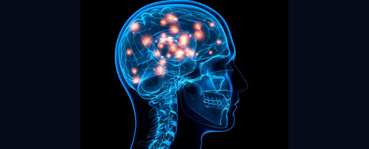 🧬 New results from MIROCALS trial (Modifying Immune Responses and Outcomes in ALS) co-led by BSMS' Professor P Nigel Leigh published in The Lancet.

This is the first study to test low-dose Interleukin 2 for ALS/MND.

More🔗bit.ly/43cM8bl