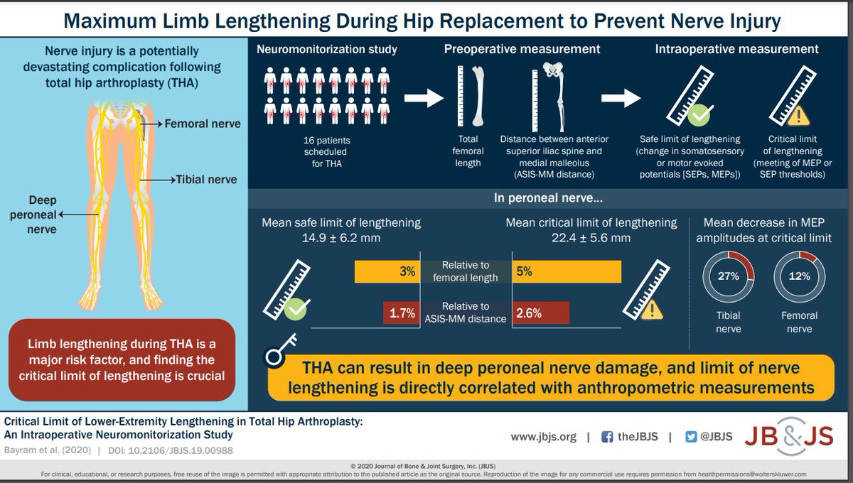 MrDLShaw's tweet photo. Critical Limits in Lower-Extremity Lengthening During THA. Intraoperative  study; safe limit of limb lengthening is 14.9 mm, while the critical limit is 22.4 mm or 5% of femoral length.  
DOI: 10.2106/JBJS.19.00988 
@JBJS #Orthopedics #THA #Surgery https://t.co/LTa3aHsfe7