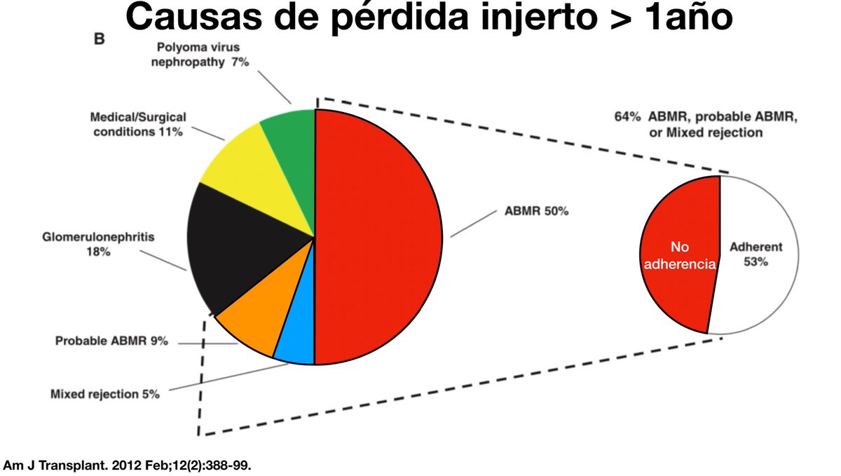 Nephro_Ivan's tweet photo. Muy buena gráfica de pastel, el rechazo mediado por anticuerpos representa hasta 2/3 partes de las pérdidas del injerto posterior al años post trasplante aún con tratamiento inmunosupresor. 
Diagnóstico oportuno es necesario. 
👇🏻👇🏻👇🏻 https://t.co/Q7T78ZB8va