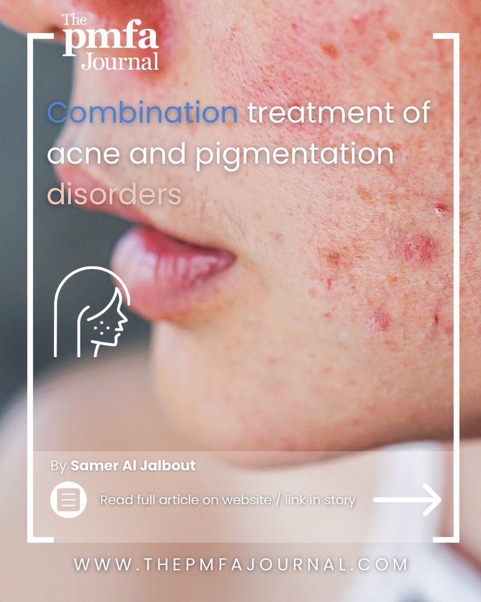 The PMFA Journal (@pmfajournal) on Twitter photo Meet the dynamic duo revolutionising stubborn acne care! BioRePeelCl3 Blue + SERA RD combine peeling science with antioxidant magic. Read the Case report by ๐๐๐ฆ๐๐ซ ๐๐ฅ ๐๐๐ฅ๐๐จ๐ฎ๐ญ <a href="/dott_sam/">Sam Mc. Dott</a> to learn more about this combination treatment.
๐: thepmfajournal.com/education/caseโฆ Meet the dynamic duo revolutionising stubborn acne care! BioRePeelCl3 Blue + SERA RD combine peeling science with antioxidant magic. Read the Case report by ๐๐๐ฆ๐๐ซ ๐๐ฅ ๐๐๐ฅ๐๐จ๐ฎ๐ญ <a href="/dott_sam/">Sam Mc. Dott</a> to learn more about this combination treatment.
๐: thepmfajournal.com/education/caseโฆ