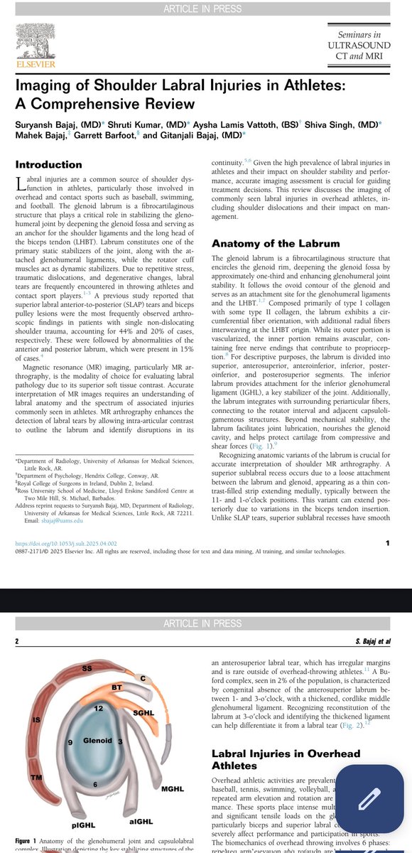 Suryansh Bajaj (@bajaj_md) on Twitter photo Check out our latest comprehensive review on imaging of shoulder labral injuries in athletes — from glenohumeral instability to lesions in overhead athletes.
authors.elsevier.com/a/1l2nH39kjLam…
#Radiology #SportsMedicine #MedTwitter
<a href="/UAMSRadiology/">UAMS Radiology</a> <a href="/gbajaj_md/">Gitanjali Bajaj</a> <a href="/shrutikumar2506/">Shruti Kumar MD</a>
<a href="/ShivaSinghMD/">Shiva Singh</a> Check out our latest comprehensive review on imaging of shoulder labral injuries in athletes — from glenohumeral instability to lesions in overhead athletes.
authors.elsevier.com/a/1l2nH39kjLam…
#Radiology #SportsMedicine #MedTwitter
<a href="/UAMSRadiology/">UAMS Radiology</a> <a href="/gbajaj_md/">Gitanjali Bajaj</a> <a href="/shrutikumar2506/">Shruti Kumar MD</a>
<a href="/ShivaSinghMD/">Shiva Singh</a>