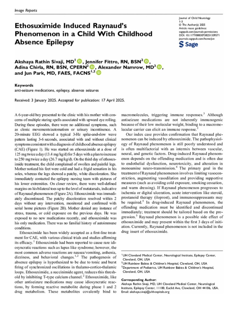 Akshay Sivaji (@akshay_sivaji92) on Twitter photo Checkout our new article!
Ethosuximide Induced Raynaud's Phenomenon
journals.sagepub.com/doi/10.1177/08…
#Seizure #NeuroX #Epilepsy
<a href="/JunParkSZMD/">Jun Park, MD</a> <a href="/CwruEpilepsy/">Case Western Reserve Univ/UH Epilepsy Program</a> Checkout our new article!
Ethosuximide Induced Raynaud's Phenomenon
journals.sagepub.com/doi/10.1177/08…
#Seizure #NeuroX #Epilepsy
<a href="/JunParkSZMD/">Jun Park, MD</a> <a href="/CwruEpilepsy/">Case Western Reserve Univ/UH Epilepsy Program</a>