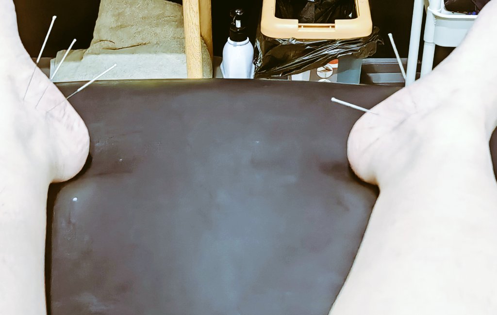 喜提电击疗程。。。
脚踝劳损，做深蹲时一个重心不稳就拉伤了。
幸好是轻伤，修养几天；
满血复活后再接再厉。