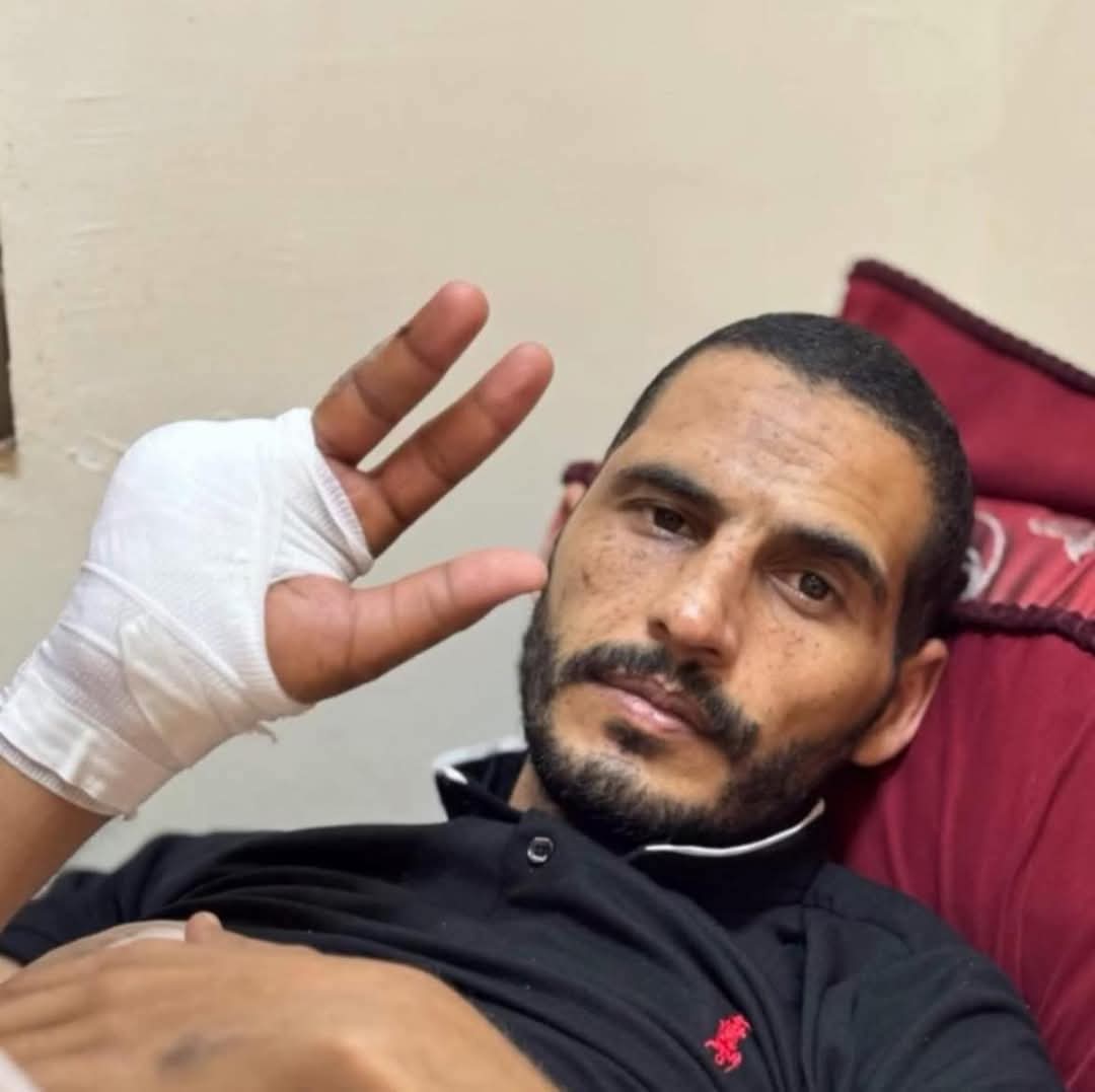 غزہ کی کہانی دنیا کو سنانے والے حسن اصلیح بھی شہید ہوگئے
وہ زخمی ہونے کے بعد غزہ کے اسپتال میں زیر علاج تھے۔ صیہونی فوج نے میزائیل فائر کرکے انہیں شہید کردیا۔ 
کبھی وہ غزہ کی خوبصورتی دنیا کو دکھاتے تھے۔ غزہ تباہ ہوا تب بھی حسن اصلیح فلسطینیوں کی زبان بنے رہے۔ 
#غزة