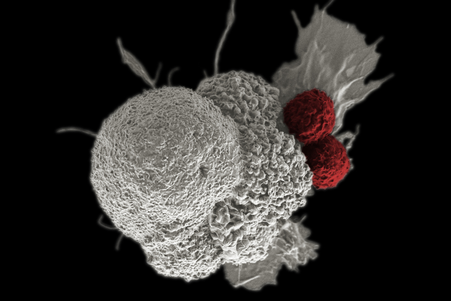 MIT School of Engineering (@mitengineering) on Twitter photo A company called <a href="/SentiBio/">Senti Biosciences</a>, founded by MIT Research Associate Tim Lu and @MITDeptofBE Prof James Collins, is giving immune cells the ability to distinguish between healthy and cancerous cells. The approach could lead to more potent cancer treatments.
news.mit.edu/2025/equipping… A company called <a href="/SentiBio/">Senti Biosciences</a>, founded by MIT Research Associate Tim Lu and @MITDeptofBE Prof James Collins, is giving immune cells the ability to distinguish between healthy and cancerous cells. The approach could lead to more potent cancer treatments.
news.mit.edu/2025/equipping…