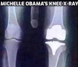 KipDynamite tweet media