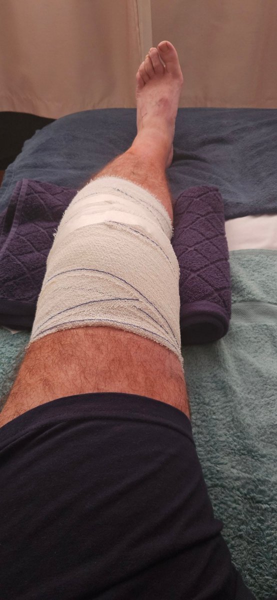 Really Frustrating day yesterday, after a near 2 year wait I finally got into the theatre for the planned procedure to be abandoned after the surgeon discovered my knee was in a worse condition that they thought, need a full knee replacement now #frustrated #Annoyed #Stillinpain