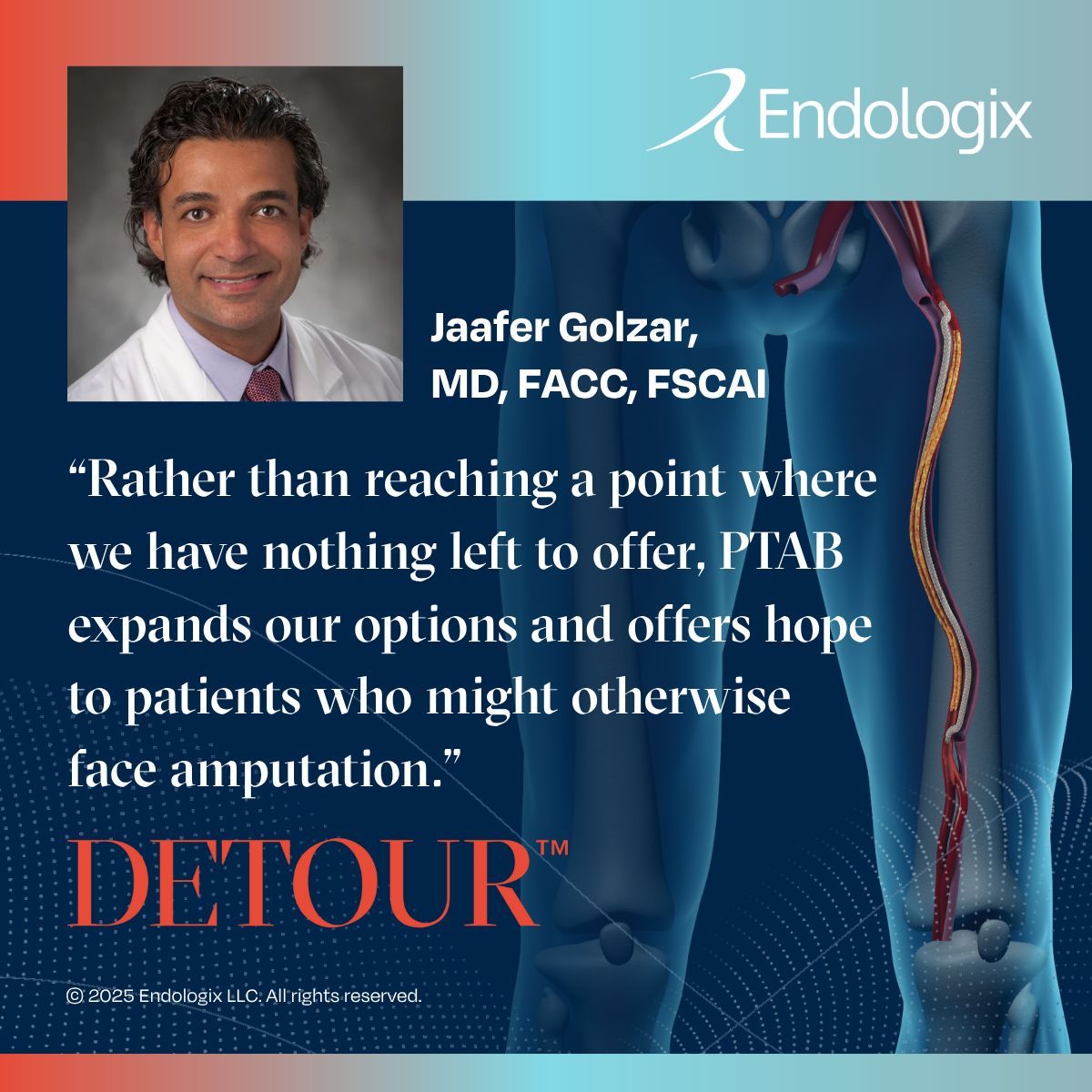 Endologix (@endologix) on Twitter photo 🔥 Hot off the press! In the latest issue of <a href="/CathLabDigest/">Cath Lab Digest</a>, <a href="/JaafGolzar/">Jaafer Golzar MD FACC, FSCAI</a> shares how the #DETOURSystem provides a valuable new tool for improving outcomes in patients who would otherwise have limited options.
Read more: hmpgloballearningnetwork.com/site/cathlab/i…
ISI: endologix.com/import-safety-… 🔥 Hot off the press! In the latest issue of <a href="/CathLabDigest/">Cath Lab Digest</a>, <a href="/JaafGolzar/">Jaafer Golzar MD FACC, FSCAI</a> shares how the #DETOURSystem provides a valuable new tool for improving outcomes in patients who would otherwise have limited options.
Read more: hmpgloballearningnetwork.com/site/cathlab/i…
ISI: endologix.com/import-safety-…
