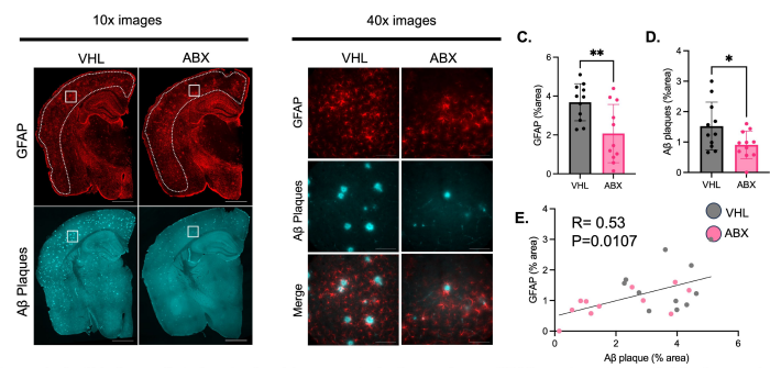 The gut microbiome controls reactive astrocytosis during Aβ amyloidosis via propionate-mediated regulation of IL-17 <a href="/jclinicalinvest/">Journal of Clinical Investigation</a> 
jci.org/articles/view/…