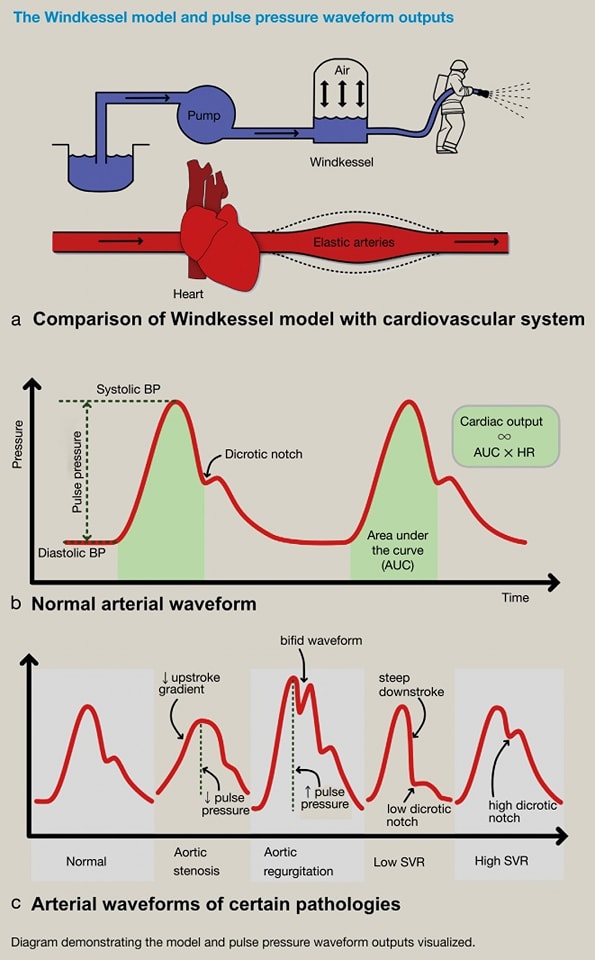 🔴Cardiac output monitoring⤵️ #2025Review #openaccess 
     
🔹anaesthesiajournal.co.uk/article/S1472-… 
 #FOAMed #MedEd #medstudent #paramedic #Cardiology #CardioEd #medtwitter #meded #CardioTwitter #cardiotwiteros  #MedX #cardiovascular #MedTwitter #medical #medEd #cardiotwitter