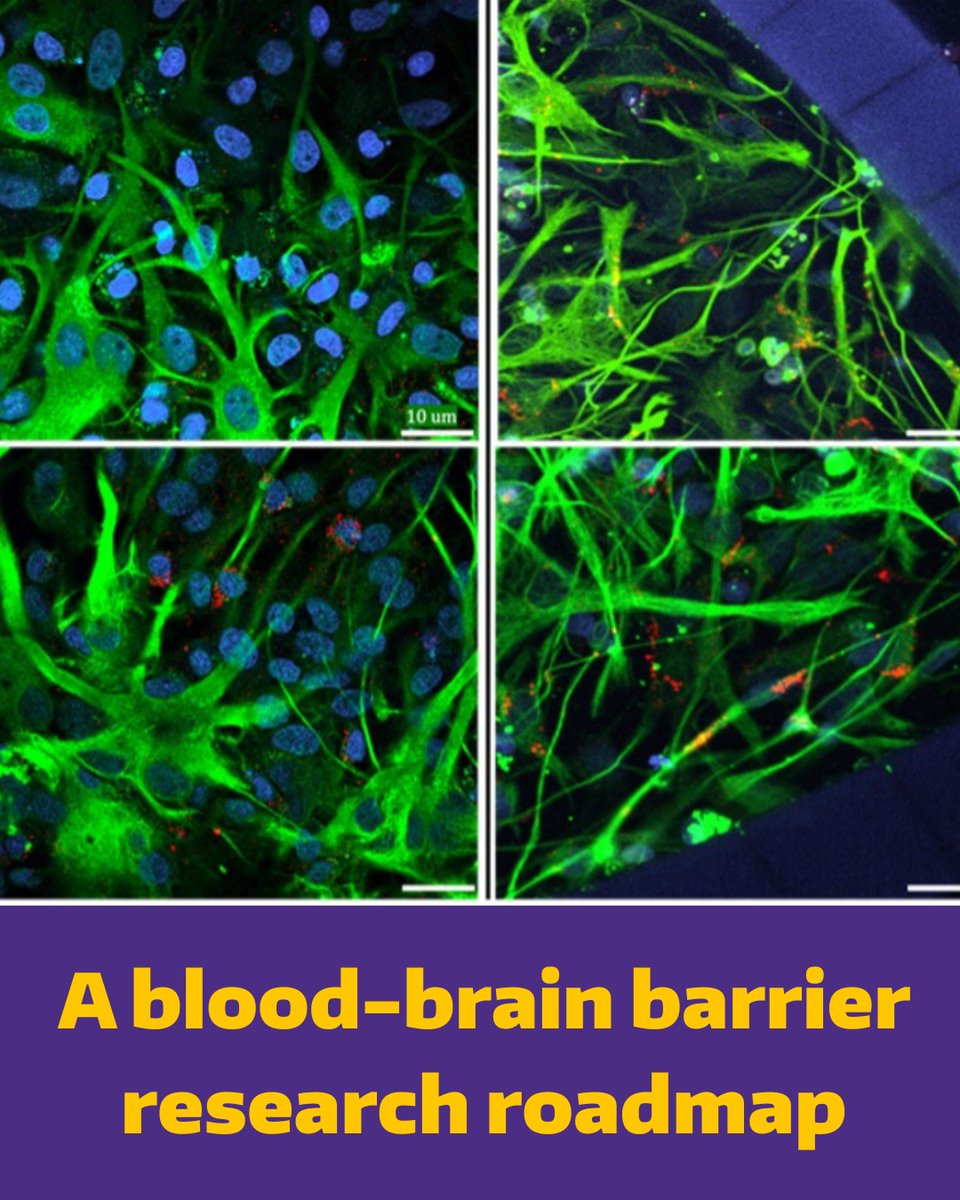 UW Chemical Engineering (@uwcheme) on Twitter photo ChemE researchers have developed a methodological roadmap for isolating blood-brain barrier cells.
These standardized methods lay the groundwork for repeatable, productive and innovative research at the intersections of #neuroscience and #engineering.
<a href="/uwengineering/">UW Engineering</a> ChemE researchers have developed a methodological roadmap for isolating blood-brain barrier cells.
These standardized methods lay the groundwork for repeatable, productive and innovative research at the intersections of #neuroscience and #engineering.
<a href="/uwengineering/">UW Engineering</a>