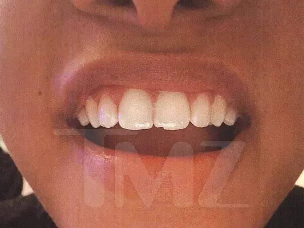 BlockTopickz's tweet image. Halle Bailey was issued a restraining order after claiming DDG physically attacked her multiple times

In docs, she claims things first got physical in January -- they broke up back in October -- and Halle says DDG came over to pick up their son, Halo, and she tried to start a…