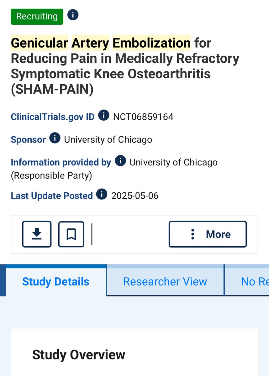 We are officially recruiting for the NIH sponsored 🍾 GAE sham study  - 3 patients have agreed in first week! 🥳🙏🏽🤲🏽 #irad 🦴 #37more