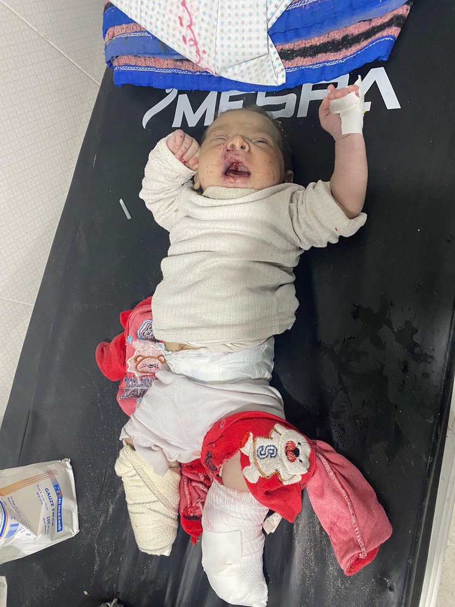 Her leg is amputated 💔
If you see this little angel, reply with 🇵🇸 pray for her 💔