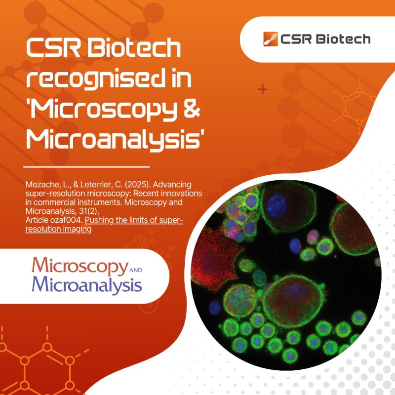 CSR Biotech (@csrbiotech) on Twitter photo It’s a proud moment for CSR Biotech to be featured in the latest review by <a href="/louisa_mezache/">Louisa Mezache</a> and <a href="/christlet/">Christophe Leterrier</a> , published in Microscopy and Microanalysis by the <a href="/MicroscopySoc/">Microscopy Society</a>
📷 Read the full review:
lnkd.in/eDW99gpb
#Microscopy #SuperResolution #LifeSciences #CSRBiotech It’s a proud moment for CSR Biotech to be featured in the latest review by <a href="/louisa_mezache/">Louisa Mezache</a> and <a href="/christlet/">Christophe Leterrier</a> , published in Microscopy and Microanalysis by the <a href="/MicroscopySoc/">Microscopy Society</a>
📷 Read the full review:
lnkd.in/eDW99gpb
#Microscopy #SuperResolution #LifeSciences #CSRBiotech
