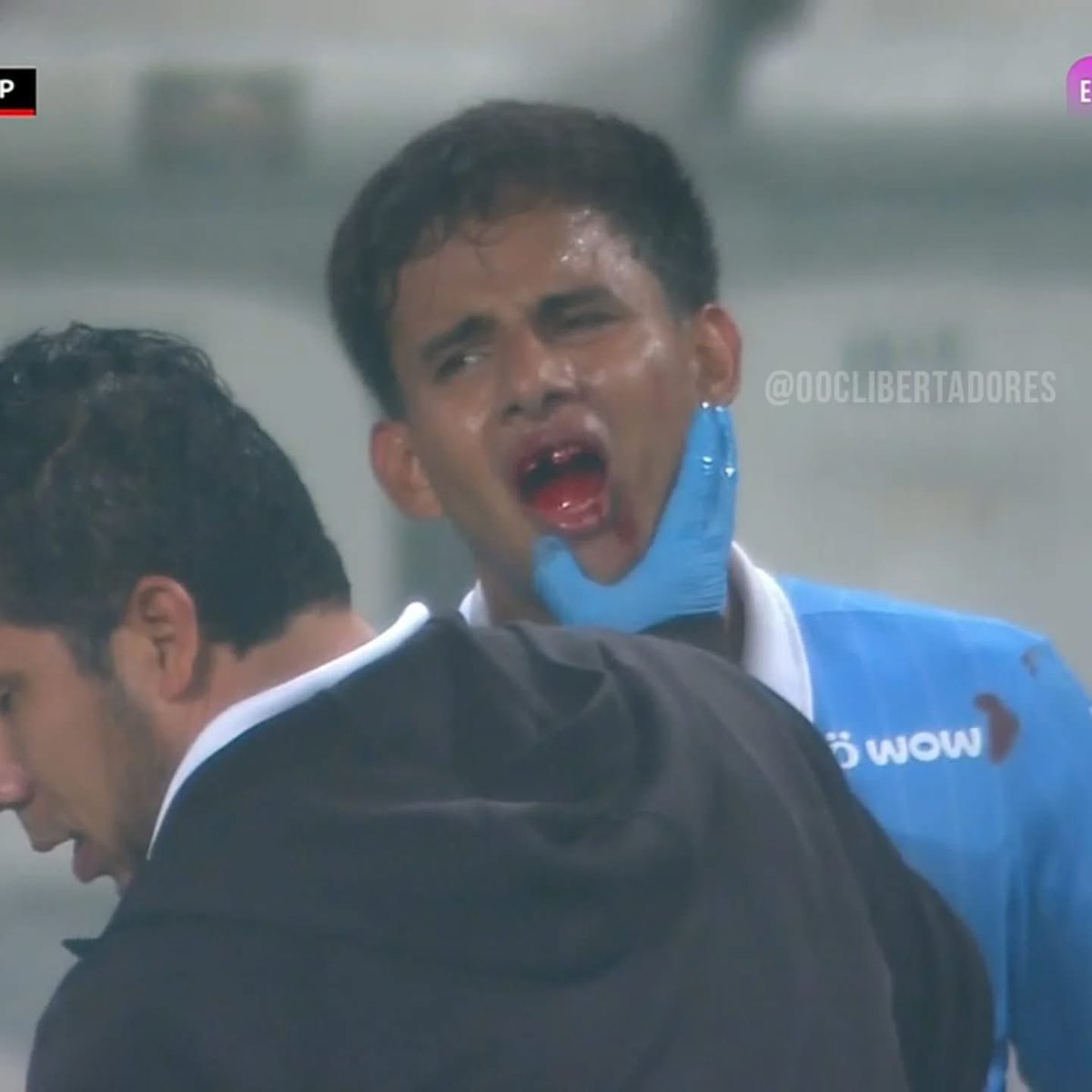 El bocón le dejó sin boca