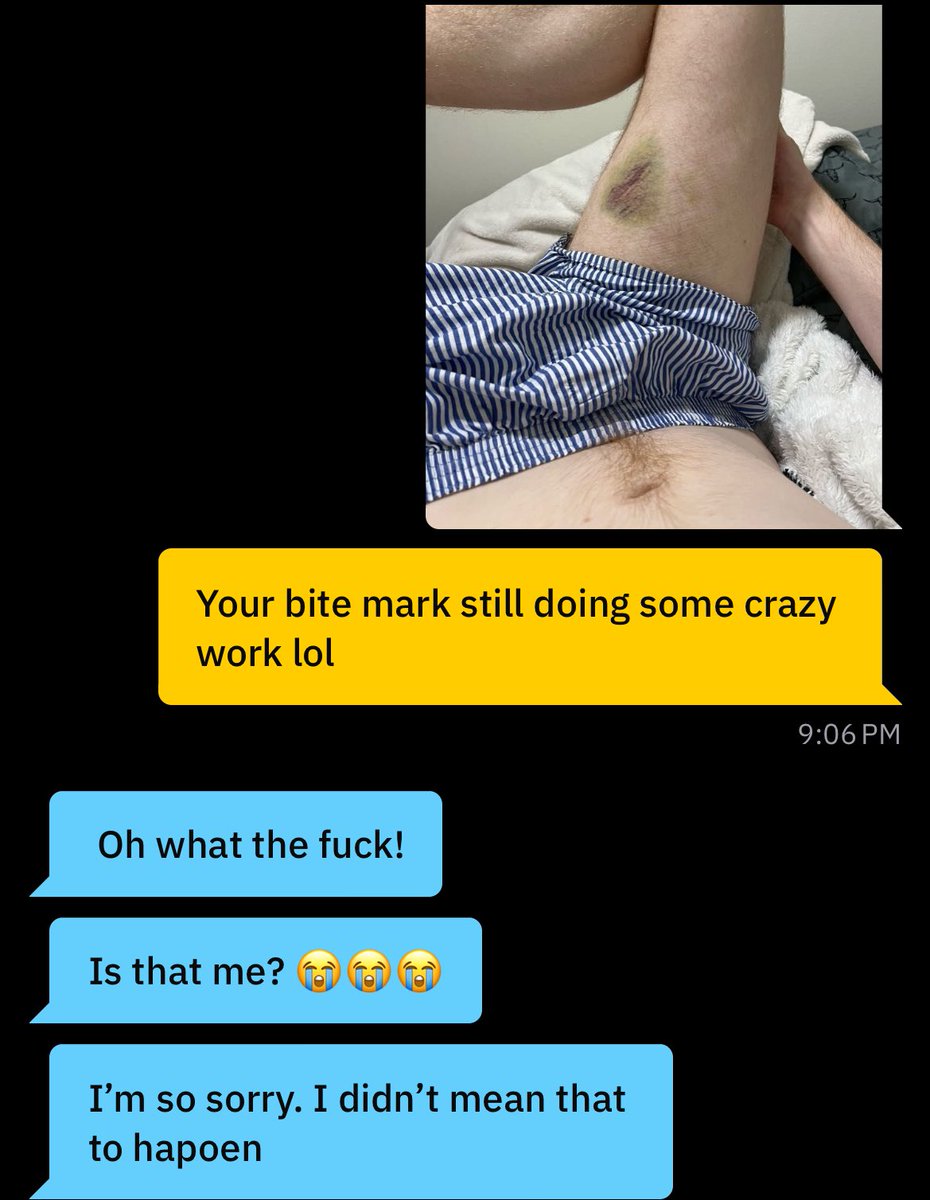 F466OT's tweet photo. Confronted my biter https://t.co/SHlCdvoT9k