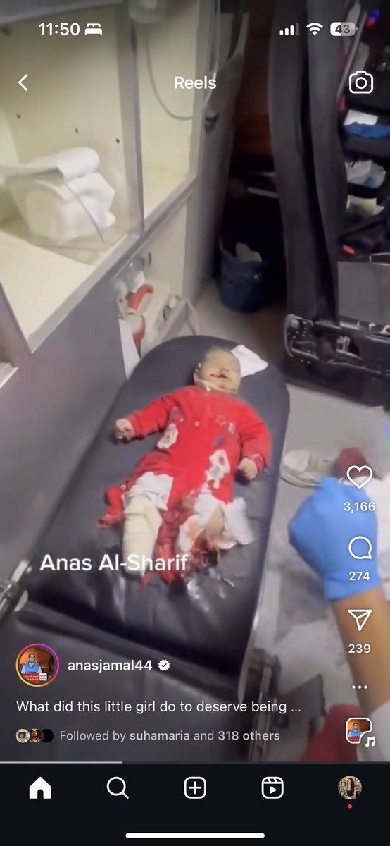 A baby, in a red onesie, not even one year old, had both her legs amputated. 

U.S. taxpayers subsidized this but no price can be placed on how much losing our humanity has cost. 

#Gaza #Nakba #Genocide #Day583
