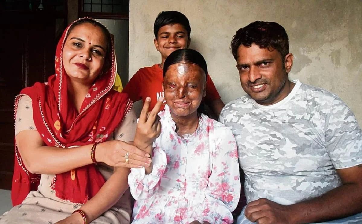 🚨 17-year-old Kafi, an acid attack survivor in Chandigarh, has topped her school in the Class 12 board exams with an impressive 95.6%. ❤️