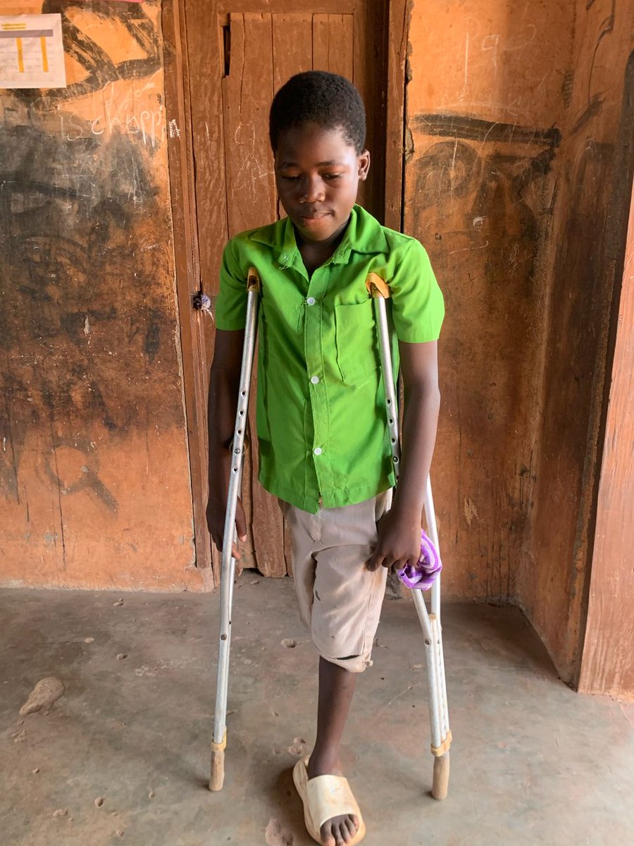 1real__oj's tweet photo. On a trip to Walewale in February, I met this boy .
Im a prosthetist, I’m ready to fabricate and fit a prosthesis for him for free, and train him until he walks again.
@CrissWaddle, if you can help me with the necessary components and also a place to base for procedure in Accra. https://t.co/oukFc83nlN