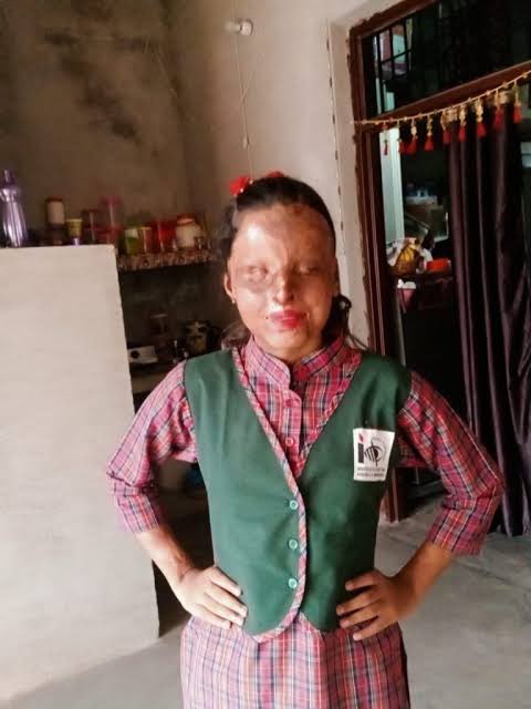 iNikhilsaini's tweet photo. Meet Kafi—proof that no force is stronger than determination. Blinded at 3 in a horrific acid attack, she spent her childhood in hospitals. But she rose, not once but twice—topping Class 10 with 95.2% and now Class 12 with 95.6%. Limitless courage. Infinite hope. https://t.co/DTt9KlitTF