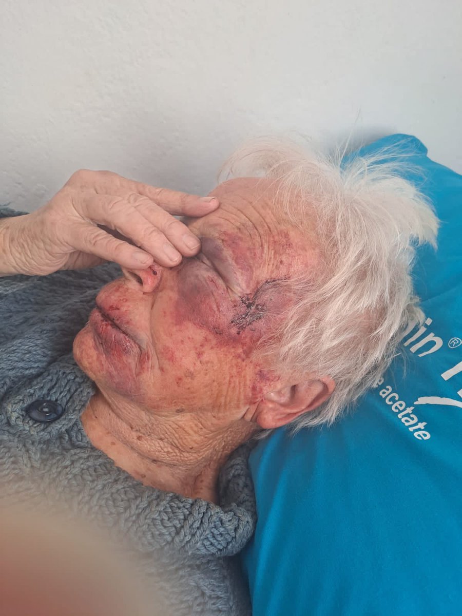 My aunt endured a vicious assault several months ago, compelling her to abandon her home of six decades. Residing now in a care facility, she grapples with profound PTSD, her former self irretrievably lost. As an Afrikaner, I find myself at the limits of endurance, exasperated by