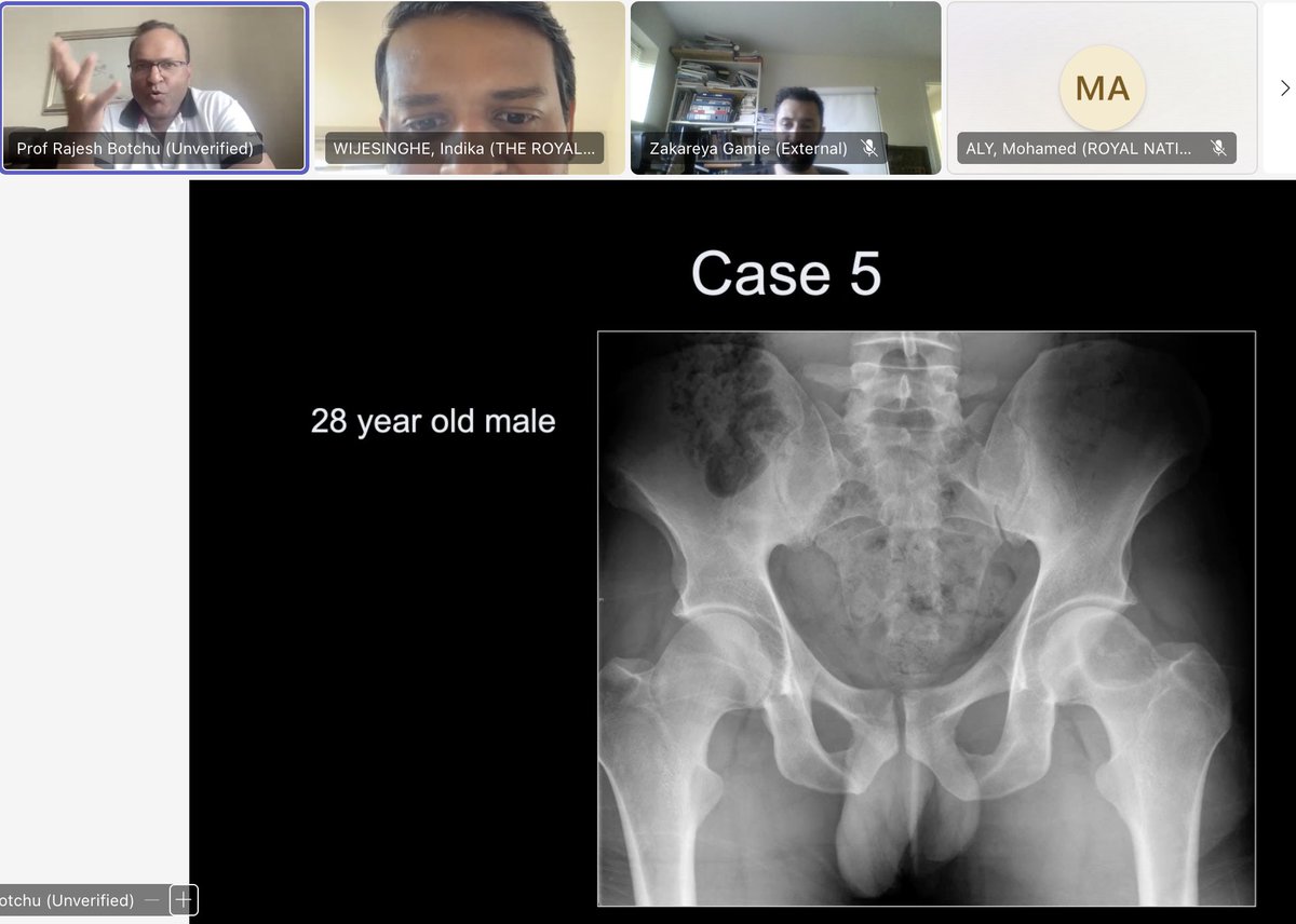 mskradiology4u (@mskradiology4u1) on Twitter photo Did a lecture on Imaging of bone tumours for Orthopedic oncology trainees in UK yesterday as part of RCR BSSR travelling professorship <a href="/BSSR_Site/">BSSR</a> <a href="/ROHImaging/">ROHImaging</a> <a href="/ROHNHSFT/">The Royal Orthopaedic Hospital</a> <a href="/MSKSocietyIndia/">MSS India</a> Did a lecture on Imaging of bone tumours for Orthopedic oncology trainees in UK yesterday as part of RCR BSSR travelling professorship <a href="/BSSR_Site/">BSSR</a> <a href="/ROHImaging/">ROHImaging</a> <a href="/ROHNHSFT/">The Royal Orthopaedic Hospital</a> <a href="/MSKSocietyIndia/">MSS India</a>