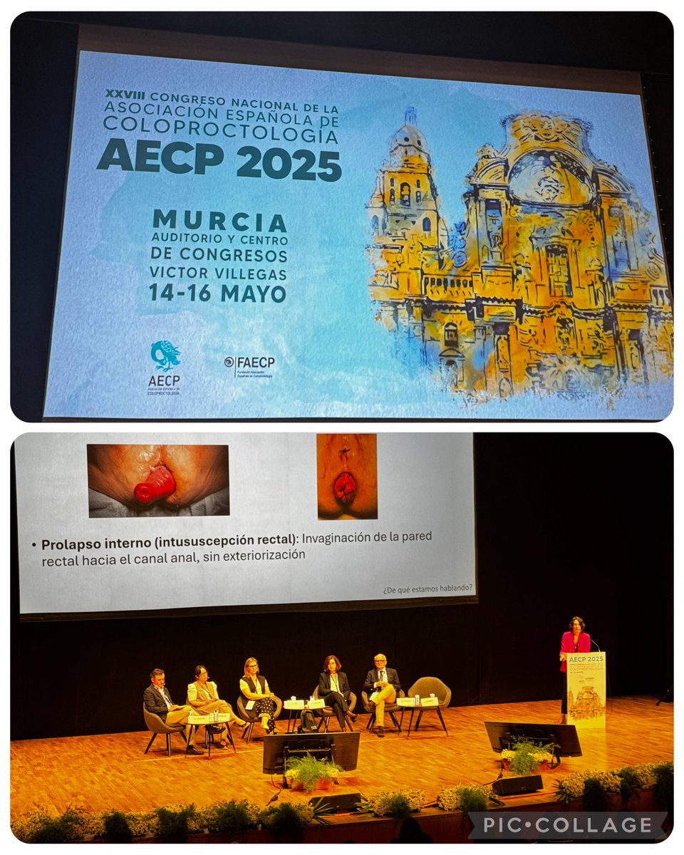 #incontinencia365dias
#XXVIIIcongresonacional
<a href="/AECP_FAECP/">AECP</a> #Murcia #Masterclas <a href="/InesAldrey/">Inés</a>  #prolapsorectal <a href="/AECP_FAECP/">AECP</a>