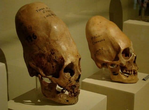 DNA Tests Reveal That Paracas Skulls Are Not Human! Here’s a summary of the key “DNA-not-human” claims and what the evidence actually shows:

Preliminary mtDNA “anomalies” reported (2014)
In February 2014, alternative-history researcher Brien Foerster announced that mitochondrial