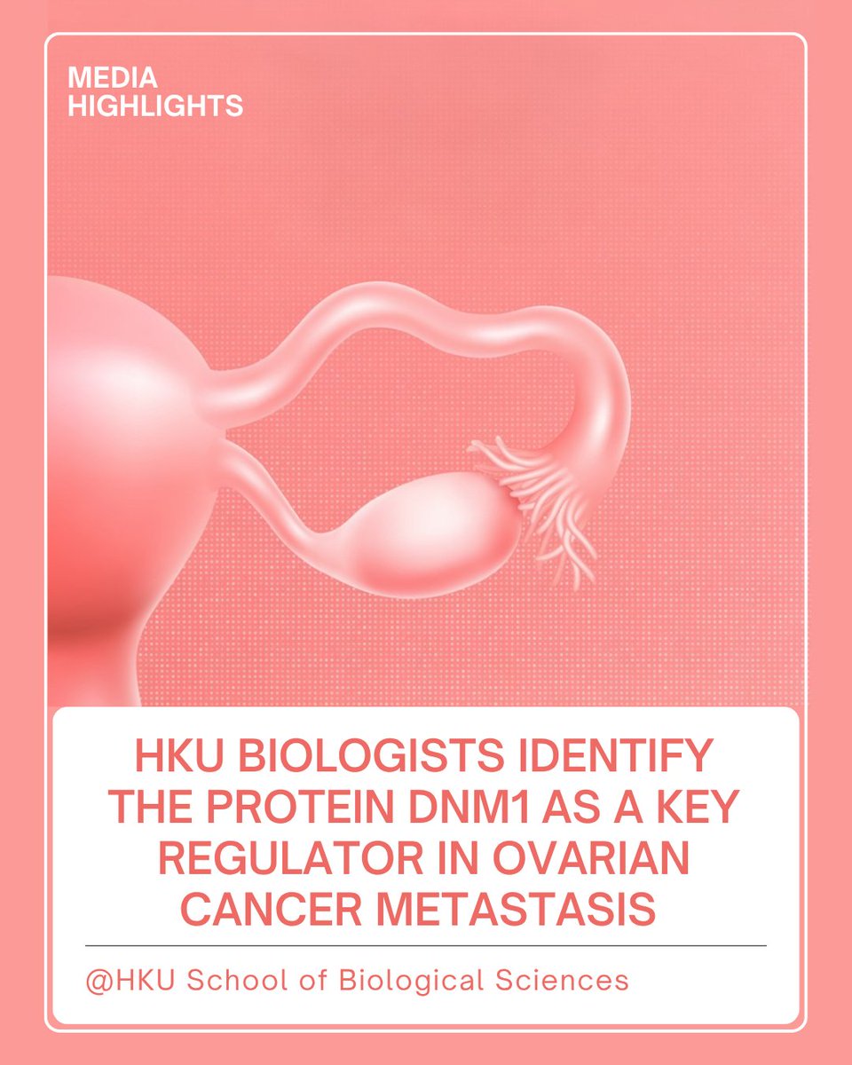 HKU_Science (@hku_science) on Twitter photo A team led by Professor Alice WONG from <a href="/HKUSBS/">HKU School of Biological Sciences</a> has discovered DNM1, a key driver of ovarian cancer spread. tinyurl.com/yv6zmw7a A team led by Professor Alice WONG from <a href="/HKUSBS/">HKU School of Biological Sciences</a> has discovered DNM1, a key driver of ovarian cancer spread. tinyurl.com/yv6zmw7a