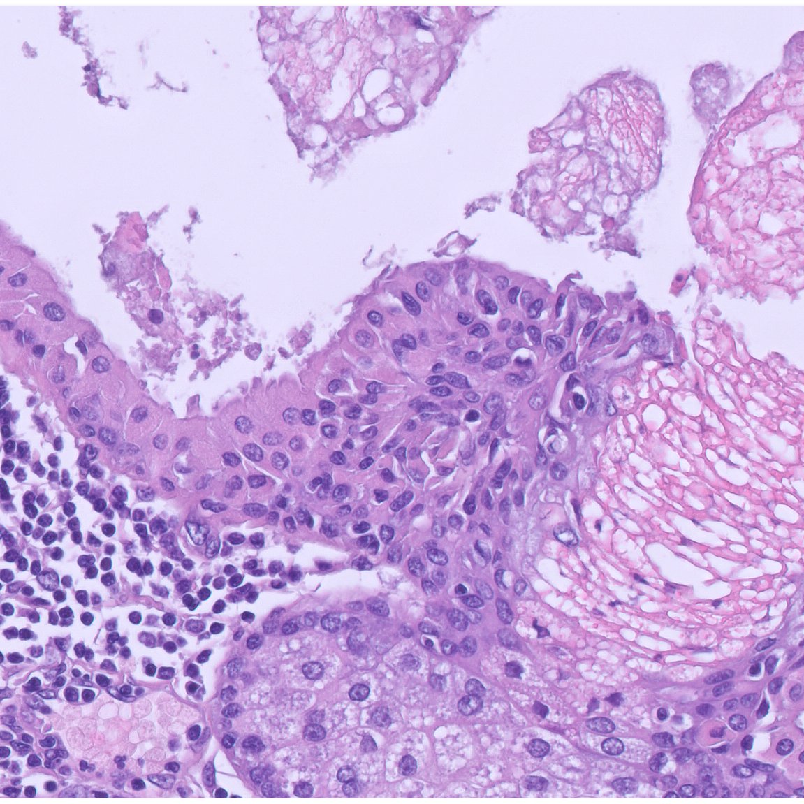 Joan Lop Gros tweet media