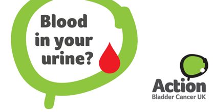 🩸 Blood in your urine, 🚽a persistent or recurrent, urgent or frequent need to wee,⚡ pelvic pain or discomfort could all be signs of #BladderCancer. If you notice symptoms, don’t wait: see your GP for advice. Find out more: bit.ly/4jrCSqO. #BladderCancerAwarenessMonth