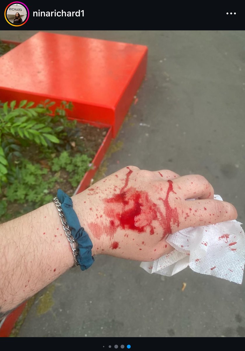🚨🇫🇷🇵🇸 ALERTE INFO – Une femme aurait été agressée en raison de son tee-shirt aux couleurs de la Palestine, sur lequel serait inscrit « Stand for Gaza ».

L’une de ses agresseuses lui aurait lancé : « J’aurais envie de t’étrangler avec ton tee-shirt. »

Elle aurait ensuite reçu