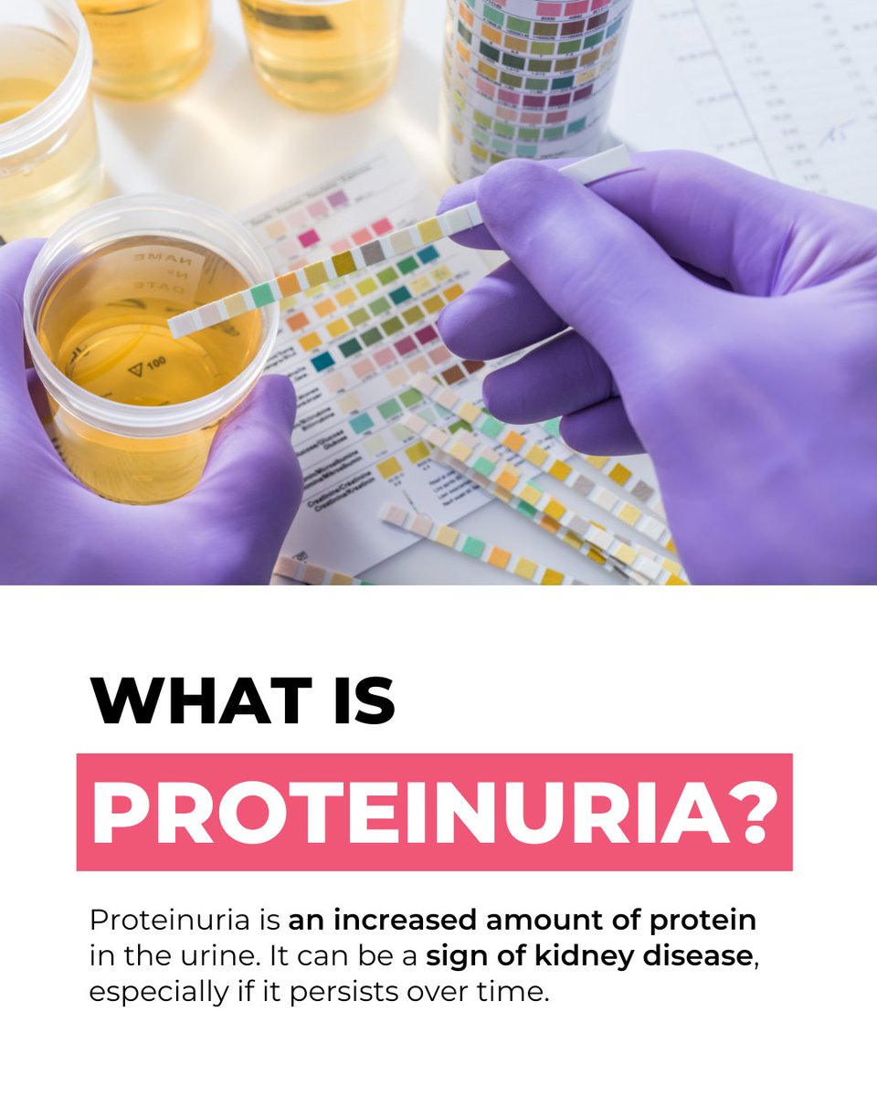 Why is there protein in my urine? 🧪
If you've been told you have proteinuria, it means your kidneys are leaking protein into your urine—something healthy kidneys usually prevent.

🔍 This can be an early sign of kidney damage, even before you feel any symptoms.

What should you