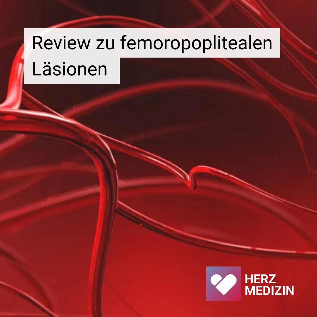 Deutsche Gesellschaft für Kardiologie (@dgk_org) on Twitter photo 🔎 Neues State-of-the-Art-Review zur endovaskulären Therapie femoropoplitealer Läsionen! Prof. <a href="/GrigoriosKoros1/">Grigorios Korosoglou</a> & Prof. <a href="/RammosChristos/">Christos Rammos</a> im Videointerview zum neuen, globalen Behandlungsalgorithmus.
📺 herzmedizin.de/fuer-aerzte-un…
#Herzmedizinde #DGK #BNK 🔎 Neues State-of-the-Art-Review zur endovaskulären Therapie femoropoplitealer Läsionen! Prof. <a href="/GrigoriosKoros1/">Grigorios Korosoglou</a> & Prof. <a href="/RammosChristos/">Christos Rammos</a> im Videointerview zum neuen, globalen Behandlungsalgorithmus.
📺 herzmedizin.de/fuer-aerzte-un…
#Herzmedizinde #DGK #BNK