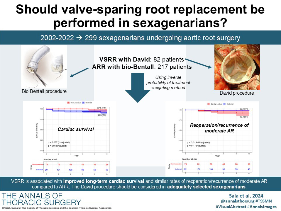 The Annals of Thoracic Surgery (@annalsthorsurg) on Twitter photo #EditorsChoice This study from Sala, de Vincentiis, and coauthors evaluated short- and long-term outcomes between valve-sparing root replacement and aortic root replacement with a biological-valved conduit in sexagenarians👇
doi.org/10.1016/j.atho…
<a href="/EZancanaroMD/">Edoardo Zancanaro MD</a> #EditorsChoice This study from Sala, de Vincentiis, and coauthors evaluated short- and long-term outcomes between valve-sparing root replacement and aortic root replacement with a biological-valved conduit in sexagenarians👇
doi.org/10.1016/j.atho…
<a href="/EZancanaroMD/">Edoardo Zancanaro MD</a>