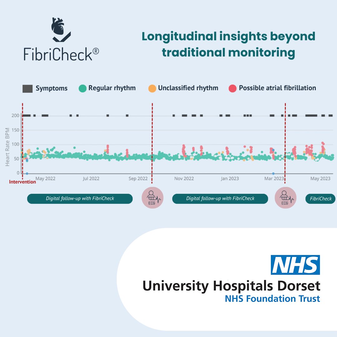 FibriCheck (@fibricheck) on Twitter photo At the <a href="/NHSDorset/">NHS Dorset</a> Royal Bournemouth Hospital, FibriCheck is now being used in a post-PVI setting. With the help of longitudinal data, healthcare providers can gain valuable insights into the heart health of their patients before and after treatment. At the <a href="/NHSDorset/">NHS Dorset</a> Royal Bournemouth Hospital, FibriCheck is now being used in a post-PVI setting. With the help of longitudinal data, healthcare providers can gain valuable insights into the heart health of their patients before and after treatment.