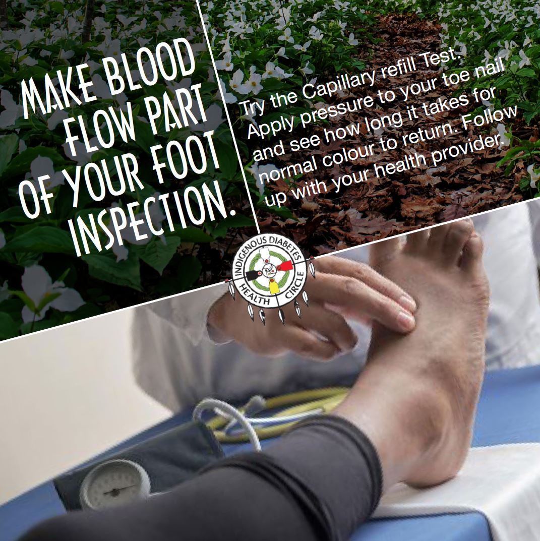 Vascular (blood flow) assessment is an essential part of special testing during your annual foot exam. A combination of visual and hands-on techniques are used to assess both the blood flow in and blood flow out of your feet.