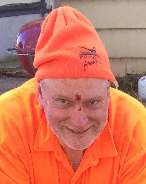 A badge of honor or a badge of stupidity?  Stuff happens… 🤷‍♂️