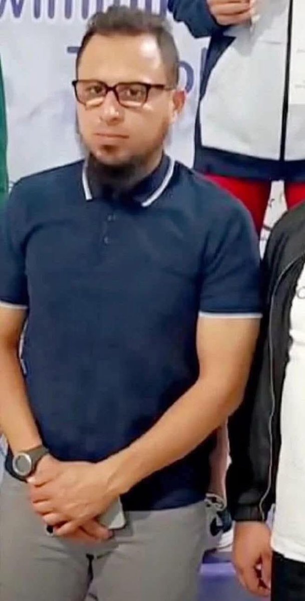 جاري التأكد من الخبر......لكن المؤكد أن هذا الإمعه حصل اصابه قويه...