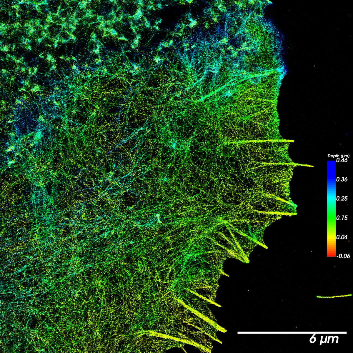 ppa007hot's tweet image. Majority of data never get the opportunity to be published. This is F-actin clearly organized in two modes, clusters or meshes, possibly mediated by formins and Arp2/3.