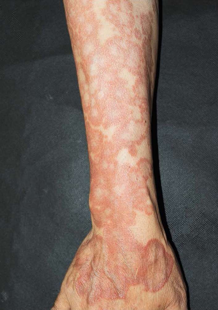 0ye_hoye_mickey's tweet photo. According to sources Pakistan has placed a large order for skin disease medicines and steroids from Turkey. In Kirana Hills, Sargodha, around 57,000 people have been found in serious condition.

#Pakistan #NuclearLeak
#KiranaHills
#USA #Turkey #Sargodha https://t.co/v2sgeikjco