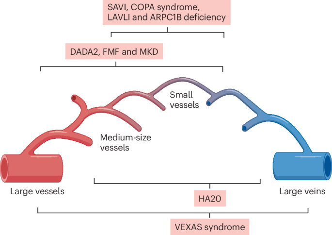 New content online: The pathogenesis, clinical presentations and treatment of monogenic systemic vasculitis bit.ly/3H6SKjY