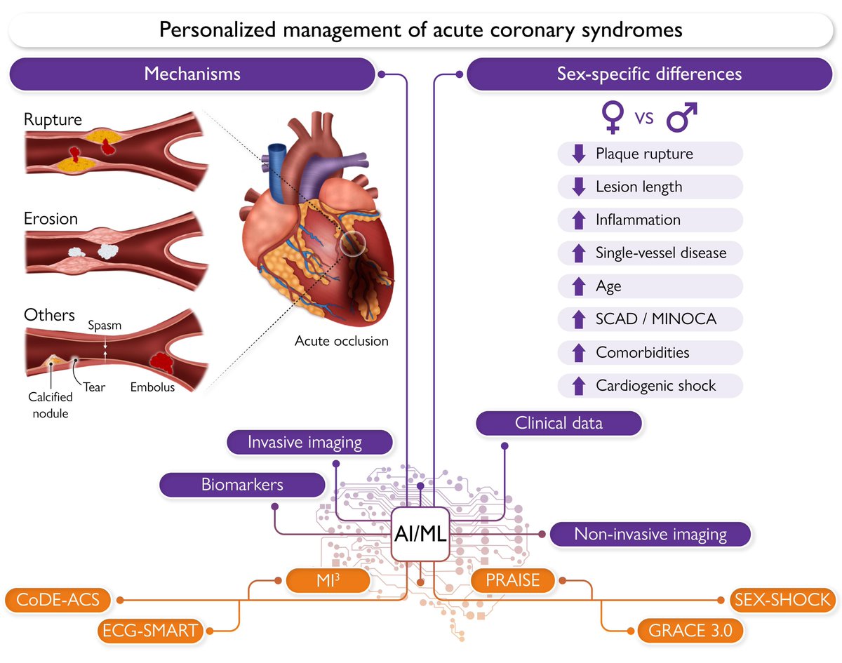 EHJ Editor-in-Chief (@ehj_ed) on Twitter photo Explore the evolving mechanisms, diagnostic challenges, and innovative treatment strategies shaping the future of acute coronary syndrome care. Read more in #EHJ.
doi.org/10.1093/eurhea…
#ACS #AMI #cardiotwitter <a href="/ESC_Journals/">European Society of Cardiology Journals</a> <a href="/escardio/">European Society of Cardiology</a> Explore the evolving mechanisms, diagnostic challenges, and innovative treatment strategies shaping the future of acute coronary syndrome care. Read more in #EHJ.
doi.org/10.1093/eurhea…
#ACS #AMI #cardiotwitter <a href="/ESC_Journals/">European Society of Cardiology Journals</a> <a href="/escardio/">European Society of Cardiology</a>