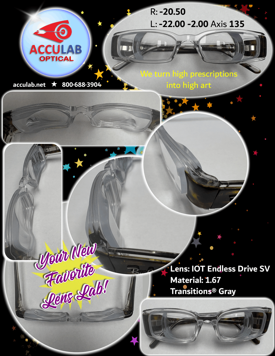 AccuLab of Illinois (@acculabillinois) on Twitter photo 👀 Feast your eyes on this high minus Rx!
R: -20.50 / L: -22.00 -2.00x135
👓 IOT Endless Drive SV | 1.67 w/ Transitions® Gen S Gray
Need a lab that handles the tough stuff? AccuLab’s got you. 💪
📞 800-688-3904
📧 info@acculab.net
#highminus #acculablenses #optician #highrx 👀 Feast your eyes on this high minus Rx!
R: -20.50 / L: -22.00 -2.00x135
👓 IOT Endless Drive SV | 1.67 w/ Transitions® Gen S Gray
Need a lab that handles the tough stuff? AccuLab’s got you. 💪
📞 800-688-3904
📧 info@acculab.net
#highminus #acculablenses #optician #highrx