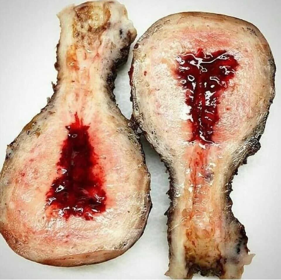 What is the organ and what was happening during death?