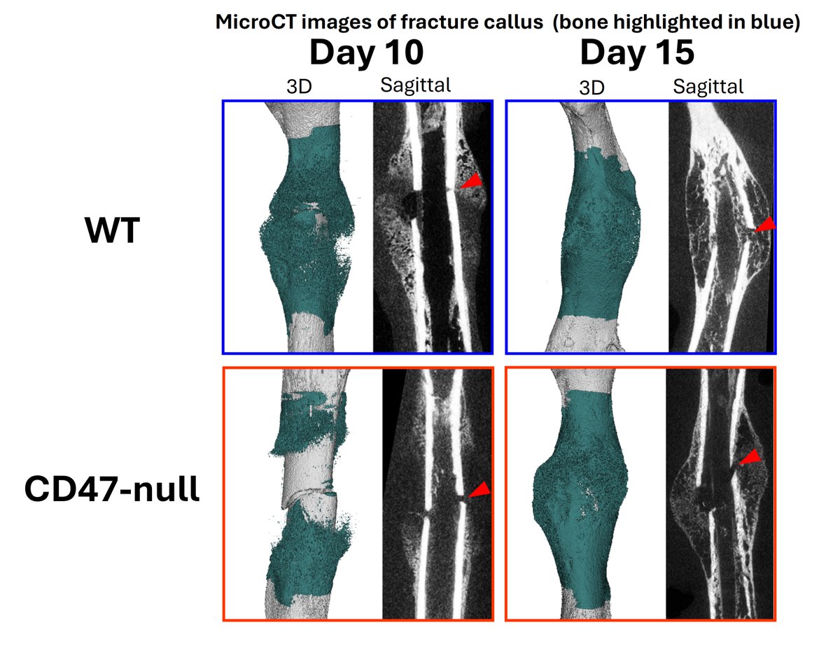 Center for Cell Plasticity and Organ Design (@um_cpod) on Twitter photo CPOD Faculty Publication Spotlight - Hankenson Lab
Read more: medicine.umich.edu/dept/cpod/news…
#GoBlueMed #UmichMedScience #Research CPOD Faculty Publication Spotlight - Hankenson Lab
Read more: medicine.umich.edu/dept/cpod/news…
#GoBlueMed #UmichMedScience #Research
