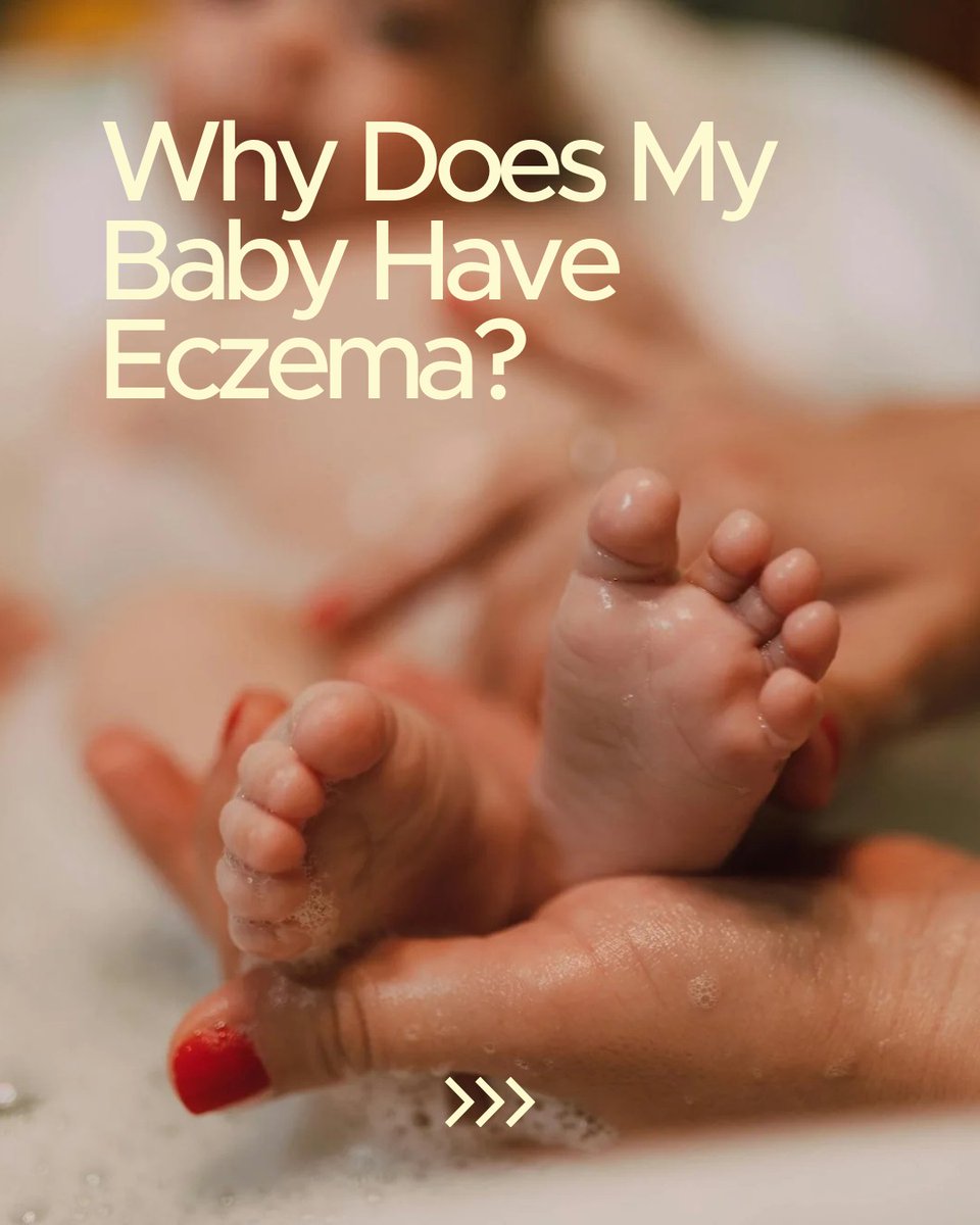 harborsleep's tweet image. Noticing dry patches or redness on your baby’s skin? It could be eczema—and you're not alone. Learn what causes it, how to soothe it, and when to talk to your pediatrician.

Head to our blog to read more — link in bio!

#BabyMonitor #BabyCamera #RestEasy #ParenthoodAdvice