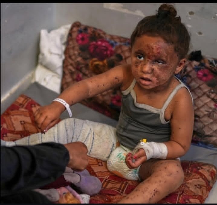 Is this the future of our children?
Two hospitals were bombed today, with dozens of innocent children among the victims.
Humanity is dying before our eyes. Where is the world’s conscience?
💔