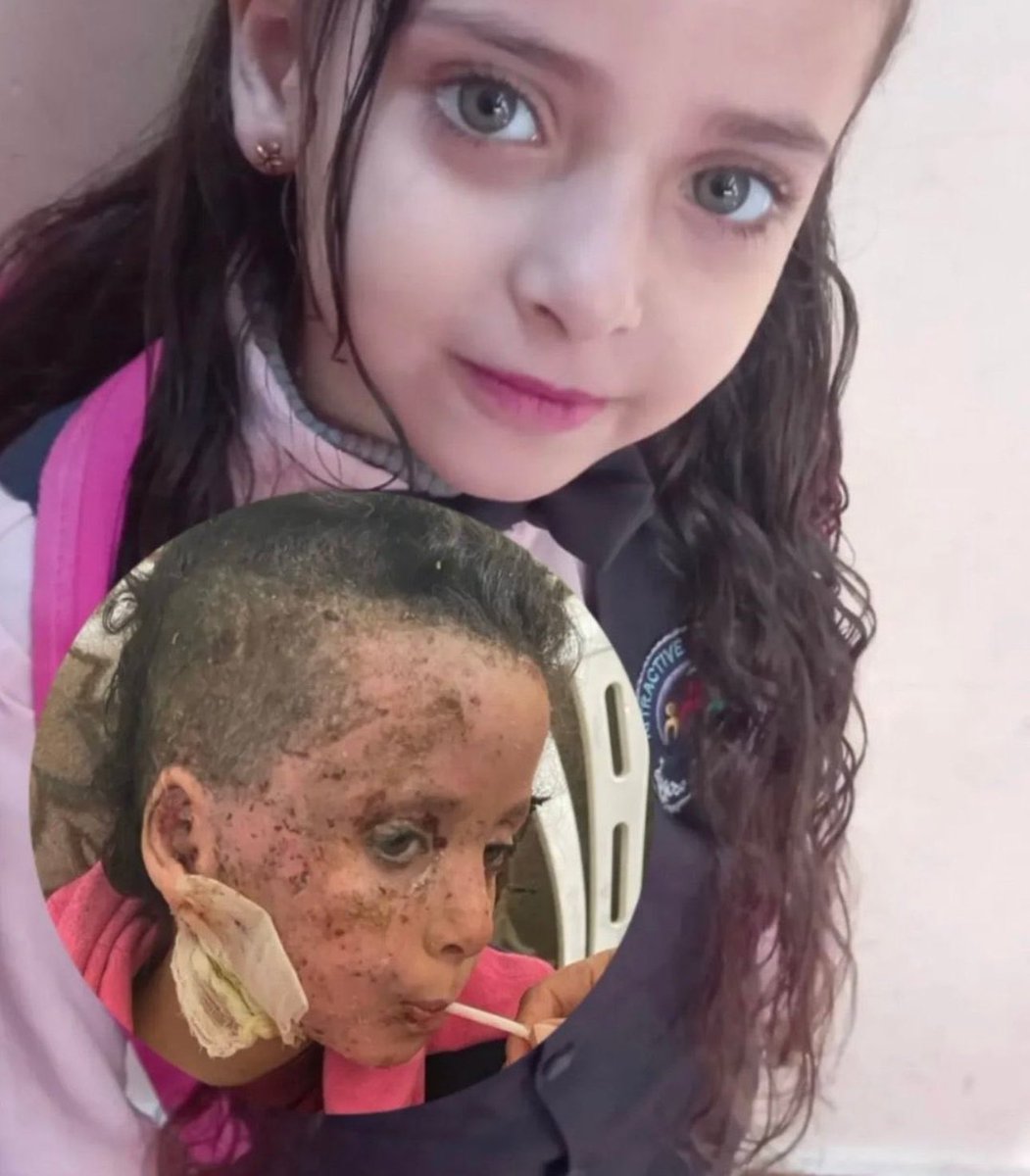 If you see this little angel, reply with 🇵🇸 pray for her 💔